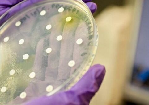 bacteriecultuur voor de diagnose van prostatitis